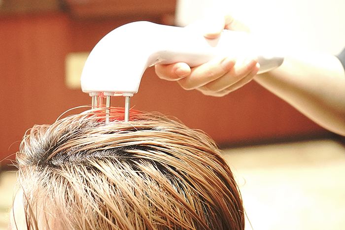 スキャルプケアイメージ